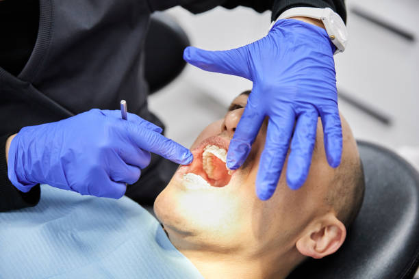 Best Emergency Wisdom Tooth Extraction in South Dos Palos, CA